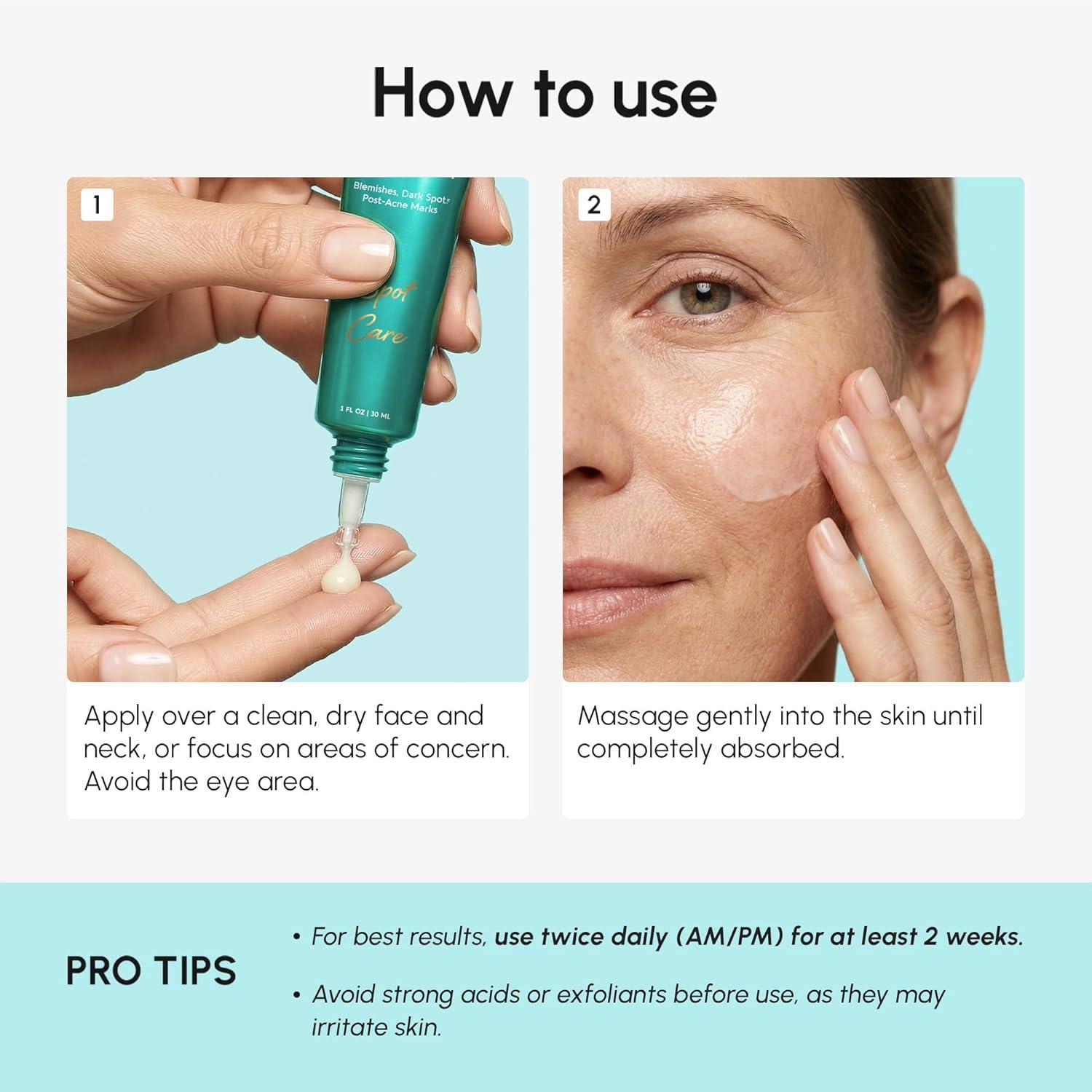 MAREE Azelaic Acid 15% Face Cream – Azelaic Acid Treatment with Niacinamide & Salicylic Acid – Dark Spot Corrector for Face, Redness Relief, Smooth Even Skin Tone – Acido Azelaico for Acne Prone Skin(1 Fl Oz (Pack of 1))