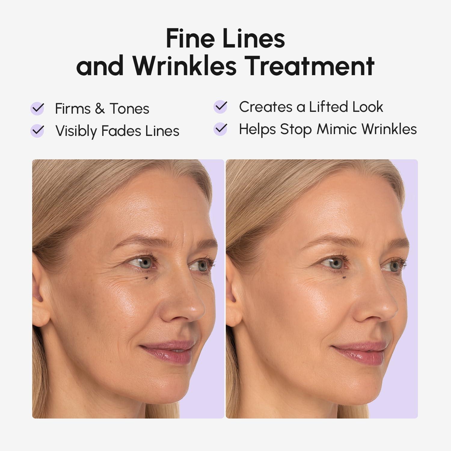 MAREE Face Lift Tape Wrinkle Patches – Anti-Wrinkle Patches for Lip – Smile Line Patches for Eyes, Neck & Forehead – Neck Lift Face Tape for Wrinkles – Overnight Lifting Stickers for Women – 224 Pcs