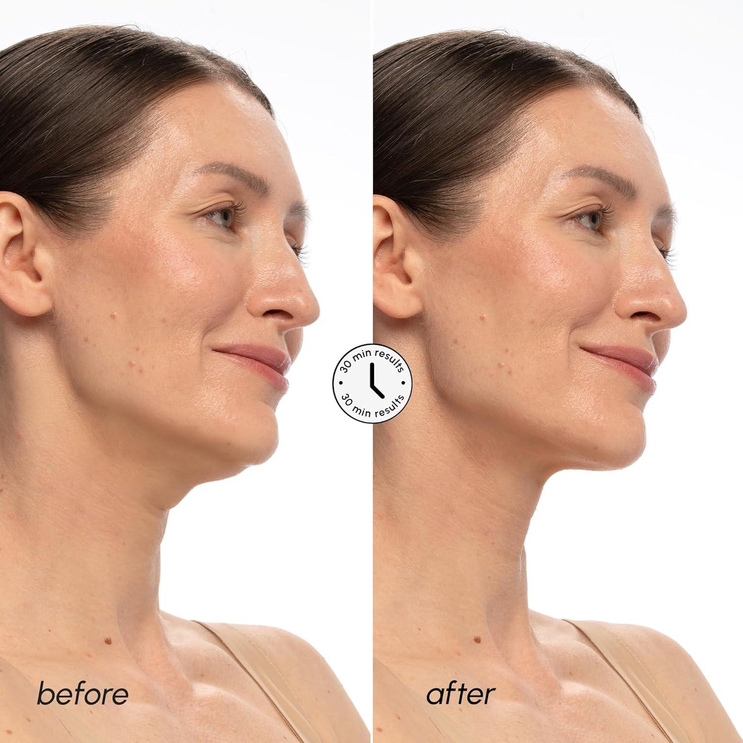 MAREE V Line Lifting Mask with 24K Gold – Deep Collagen Face Mask for Women – Jawline Shaper Mask with Retinol & Hyaluronic Acid – Neck Tightening & Firming – Double Chin Strap for Face Lift(PDRN)