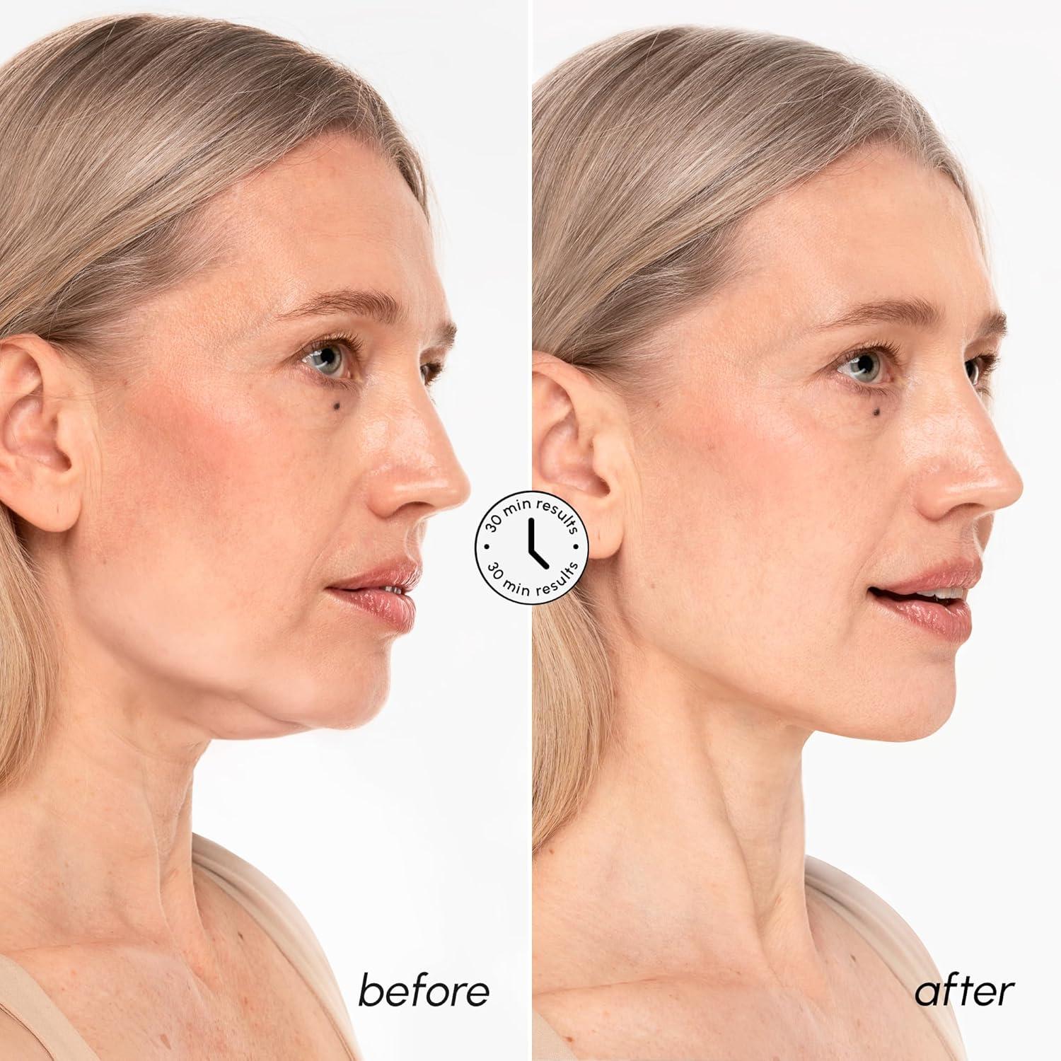 MAREE V Line Lifting Mask with 24K Gold – Deep Collagen Face Mask for Women – Jawline Shaper Mask with Retinol & Hyaluronic Acid – Neck Tightening & Firming – Double Chin Strap for Face Lift(24K Gold)