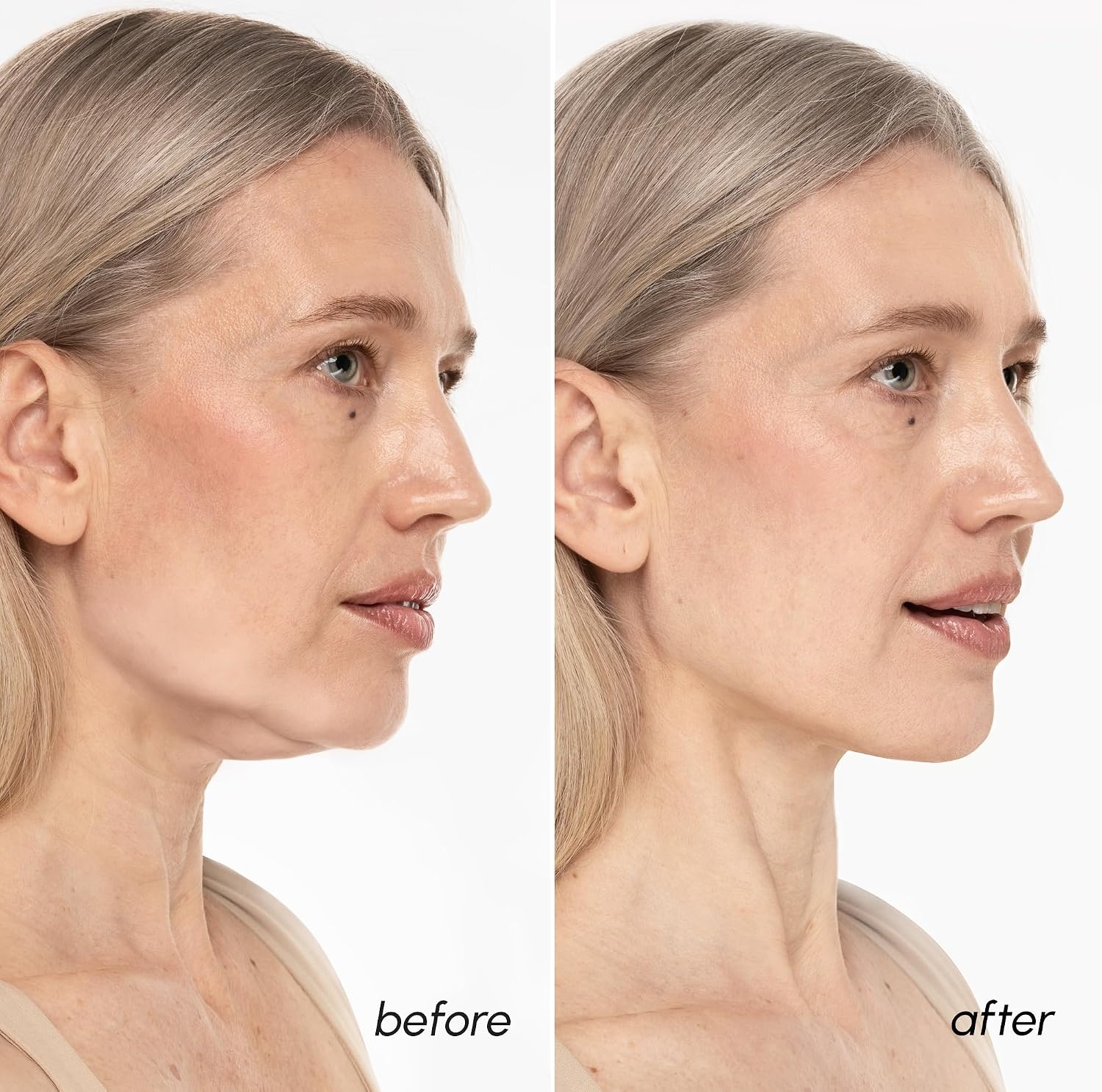 MAREE V Line Lifting Mask with PDRN Salmon DNA – Deep Collagen Face Mask for Women – Jawline Shaper Facial Masks with Retinol – Tightening & Firming Neck Lift Tape – Double Chin Strap for Face Lift(Gold)