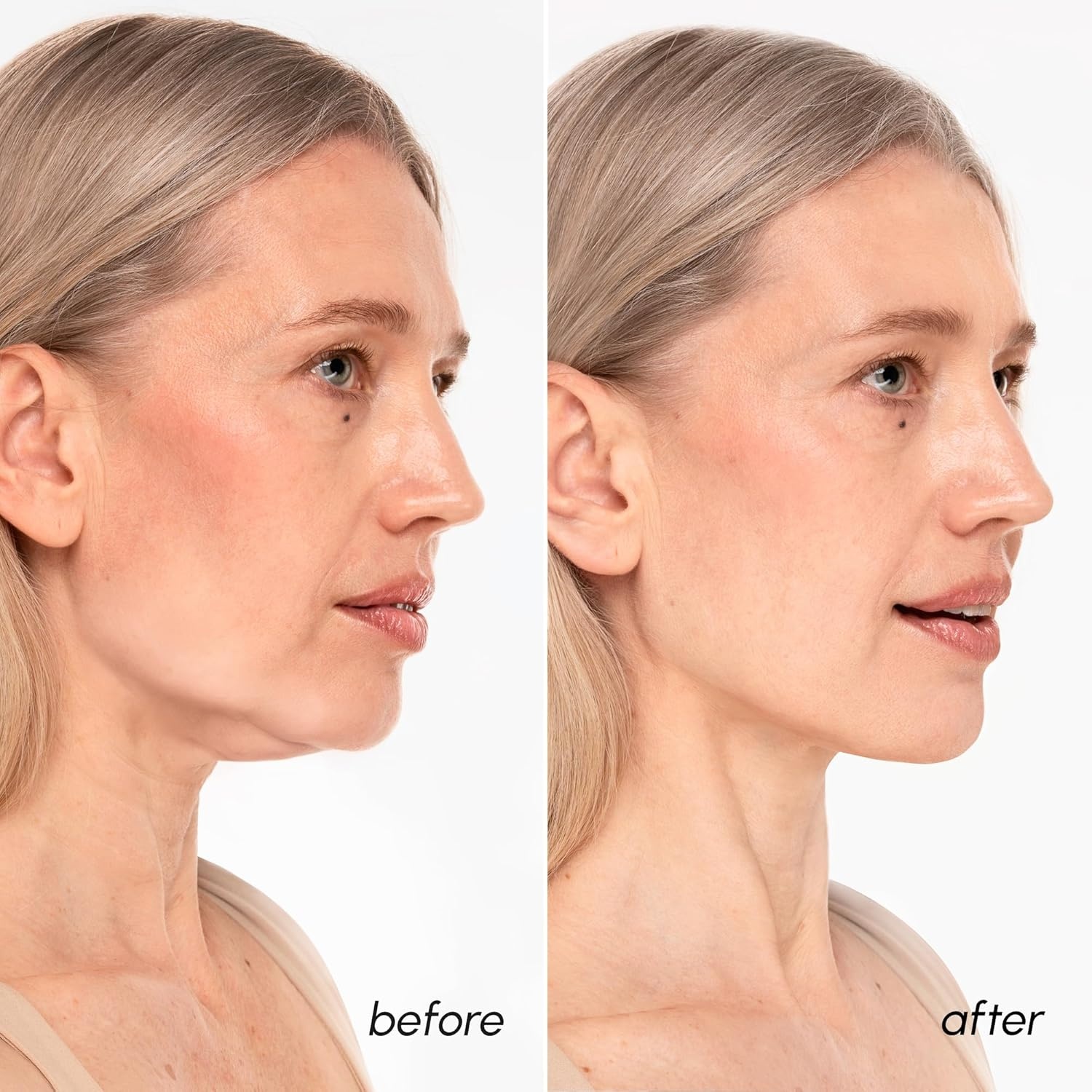 MAREE V Line Lifting Mask with PDRN Salmon DNA – Deep Collagen Face Mask for Women – Jawline Shaper Facial Masks with Retinol – Tightening & Firming Neck Lift Tape – Double Chin Strap for Face Lift(Gold)