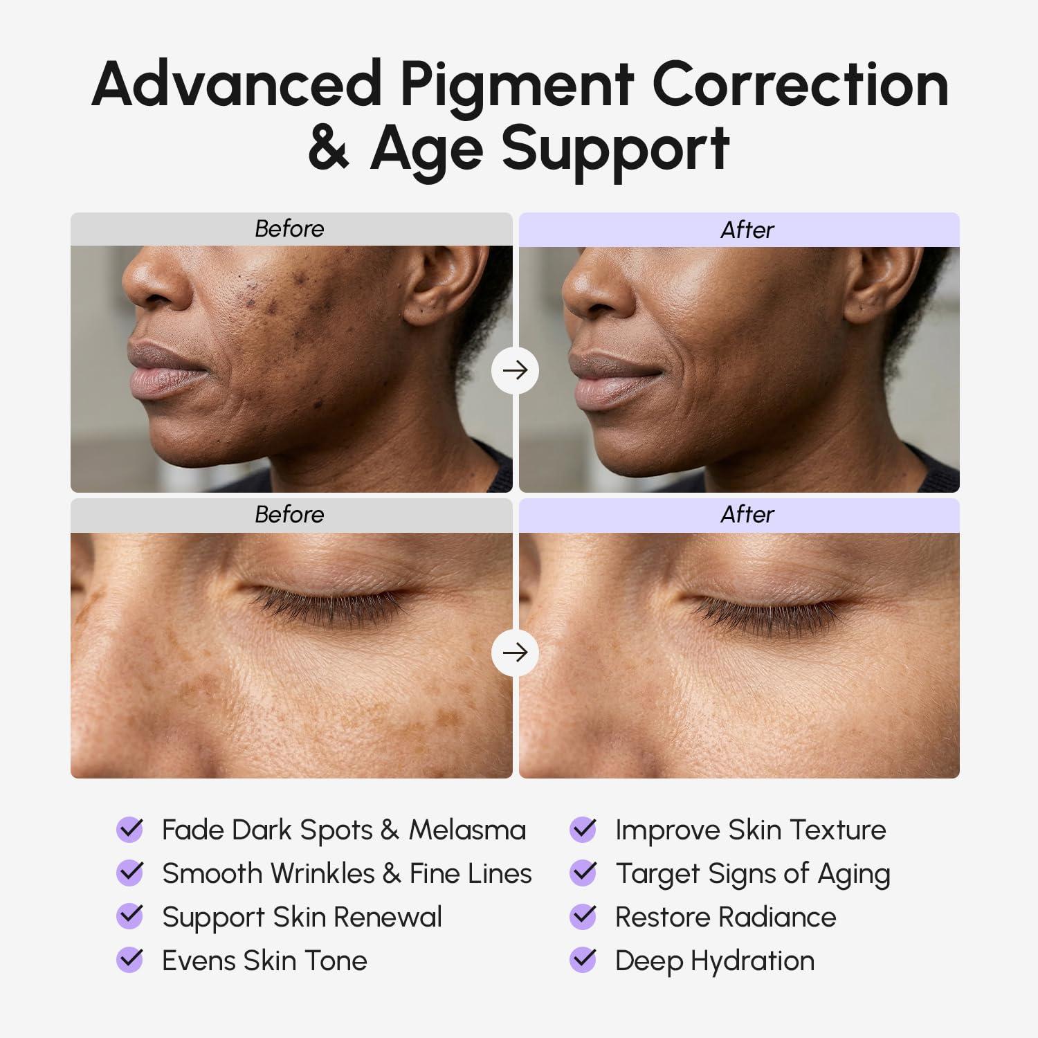MAREE TXA Tranexamic Acid Serum Cream with Microspicules 100,000 PPM Complex – Alpha Arbutin Cream – Face Crema para Manchas Oscuras en la Cara(Purpl)