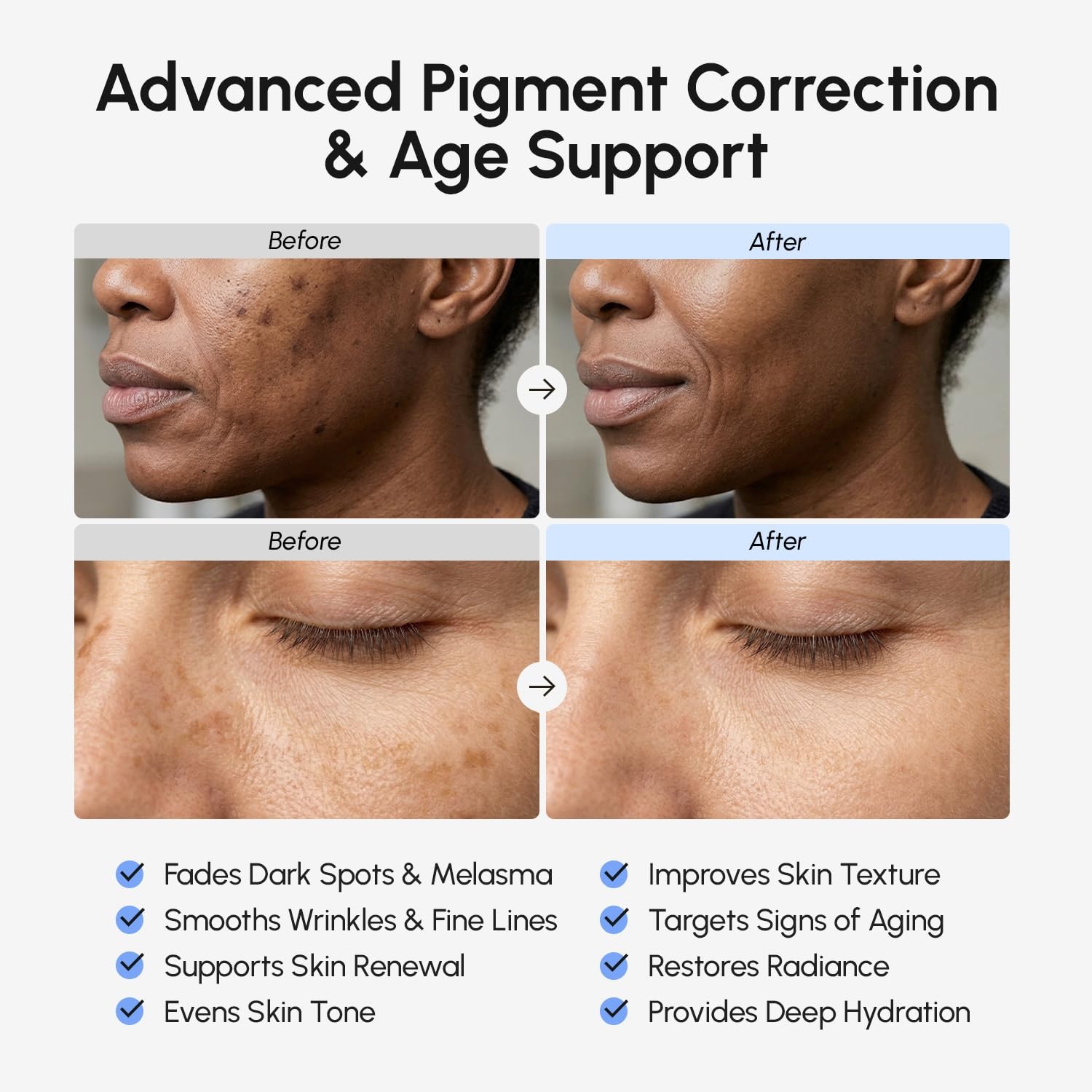 MAREE 10% Tranexamic Serum Cream – Alpha Arbutin Cream with Tranexamic Acid, Niacinamide – Dark Spot Corrector with Alfa Arbutin – Acido Tranexamico Crema para Manchas Oscuras en la Cara(Dark Blue)