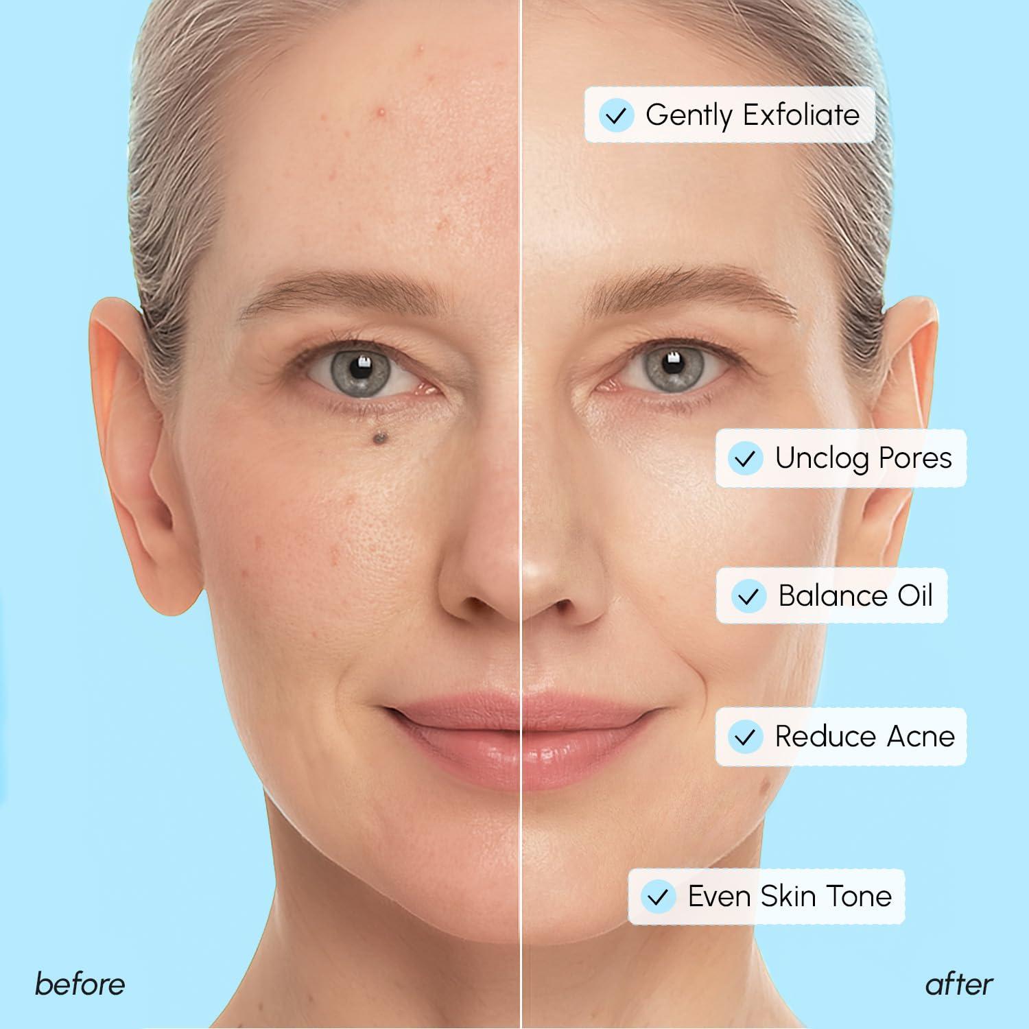 MAREE Glycolic Acid Pads – Toner Pads for Face Cleansing – Exfoliating Pad with Tea Tree Oil, Salicylic Acid & Vitamins E, B3, B5 – Acne Clearing, Skin Pore Resurfacing & Radiance Device – 80 Count(Glycolic Salicylic Pads)