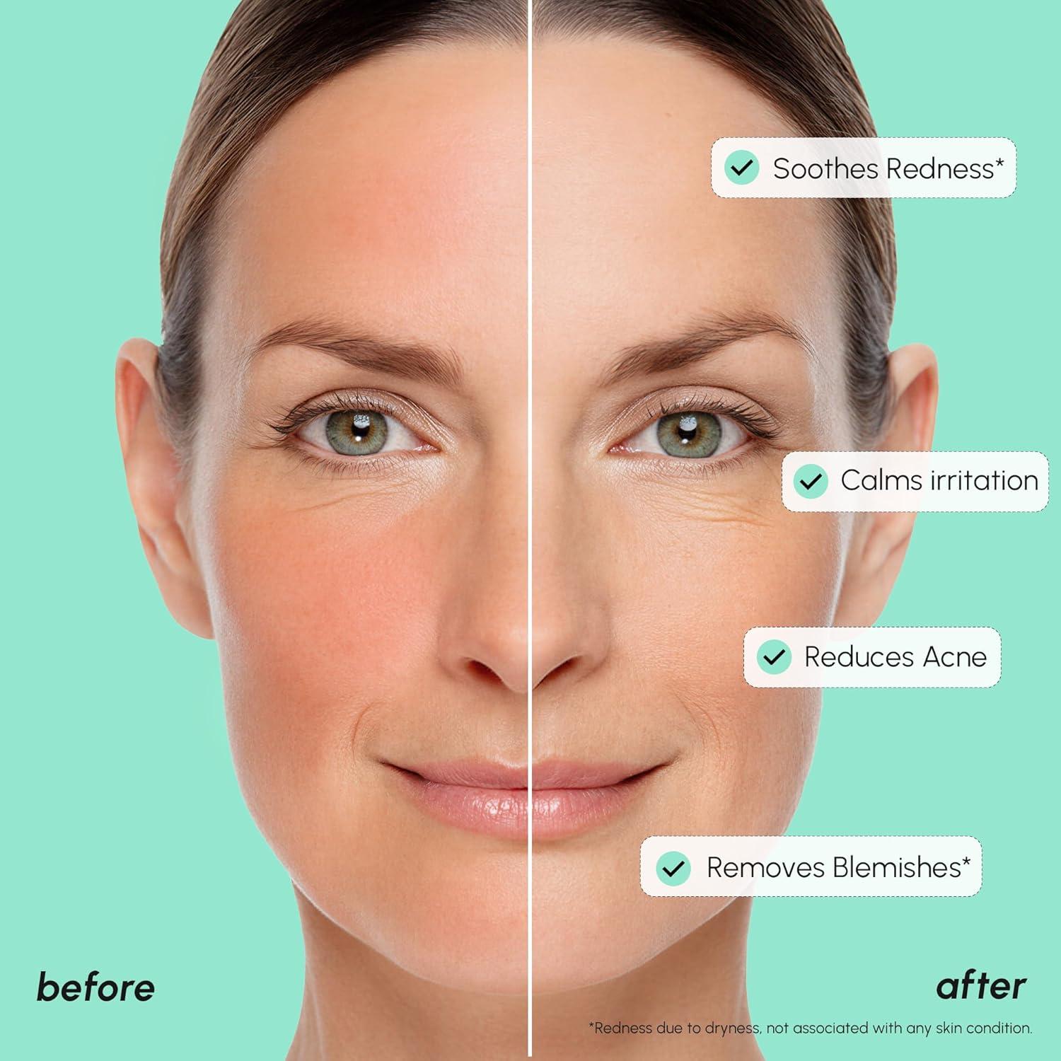 MAREE 20% Tranexamic Acid Serum Complex with Niacinamide & Vitamin C – Serum for Face & Body Dark Spot Corrector – Age Spots Hyperpigmentation Care Remover – Brightening Acido Tranexamico para Manchas(Azelaic Acid Face Serum)