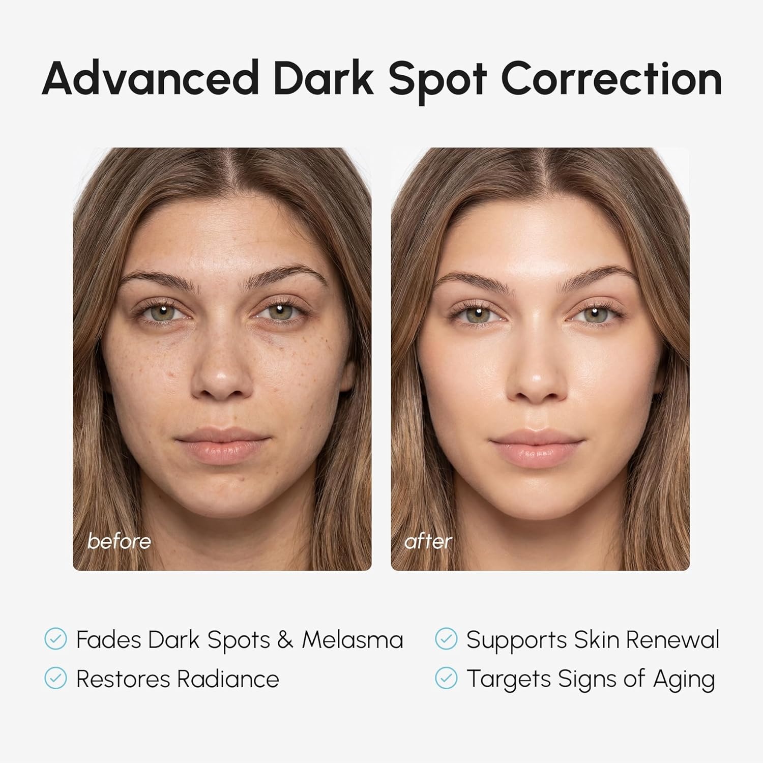 MAREE 10% Tranexamic Serum Cream – Alpha Arbutin Cream with Tranexamic Acid, Niacinamide – Dark Spot Corrector with Alfa Arbutin – Acido Tranexamico Crema para Manchas Oscuras en la Cara(White)