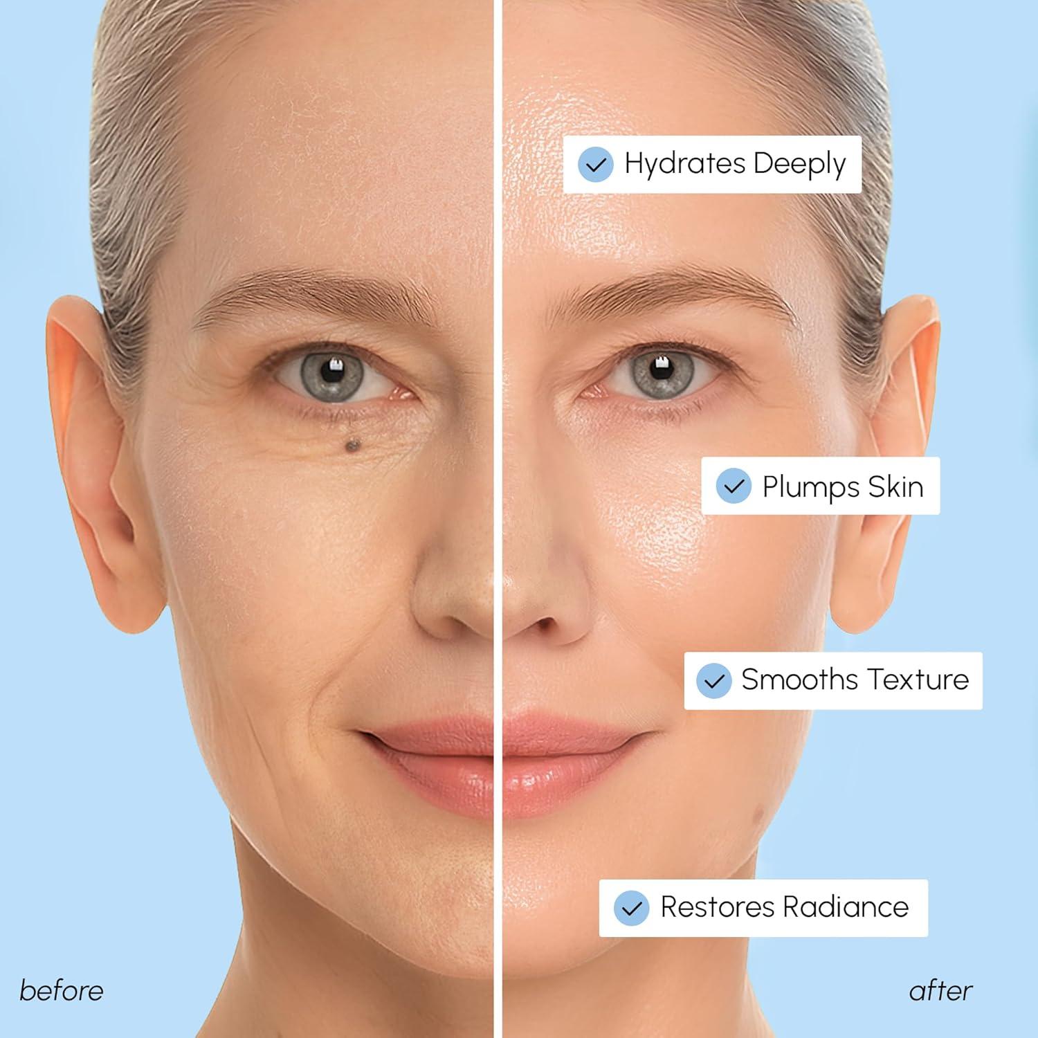 MAREE Hyaluronic Acid Toner Pads – Hydrating Face Wipes for Women Cleansing – Zero Pore Toning Brightening Exfoliating Face Pads – Pore Reducer Facial Peels – Acne Treatment Device(Sky Blue)