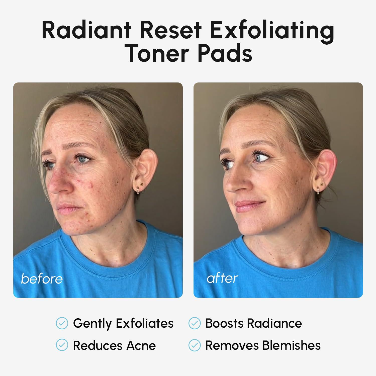 MAREE Hyaluronic Acid Toner Pads – Hydrating Face Wipes for Women Cleansing – Zero Pore Toning Brightening Exfoliating Face Pads – Pore Reducer Facial Peels – Acne Treatment Device(Blue)