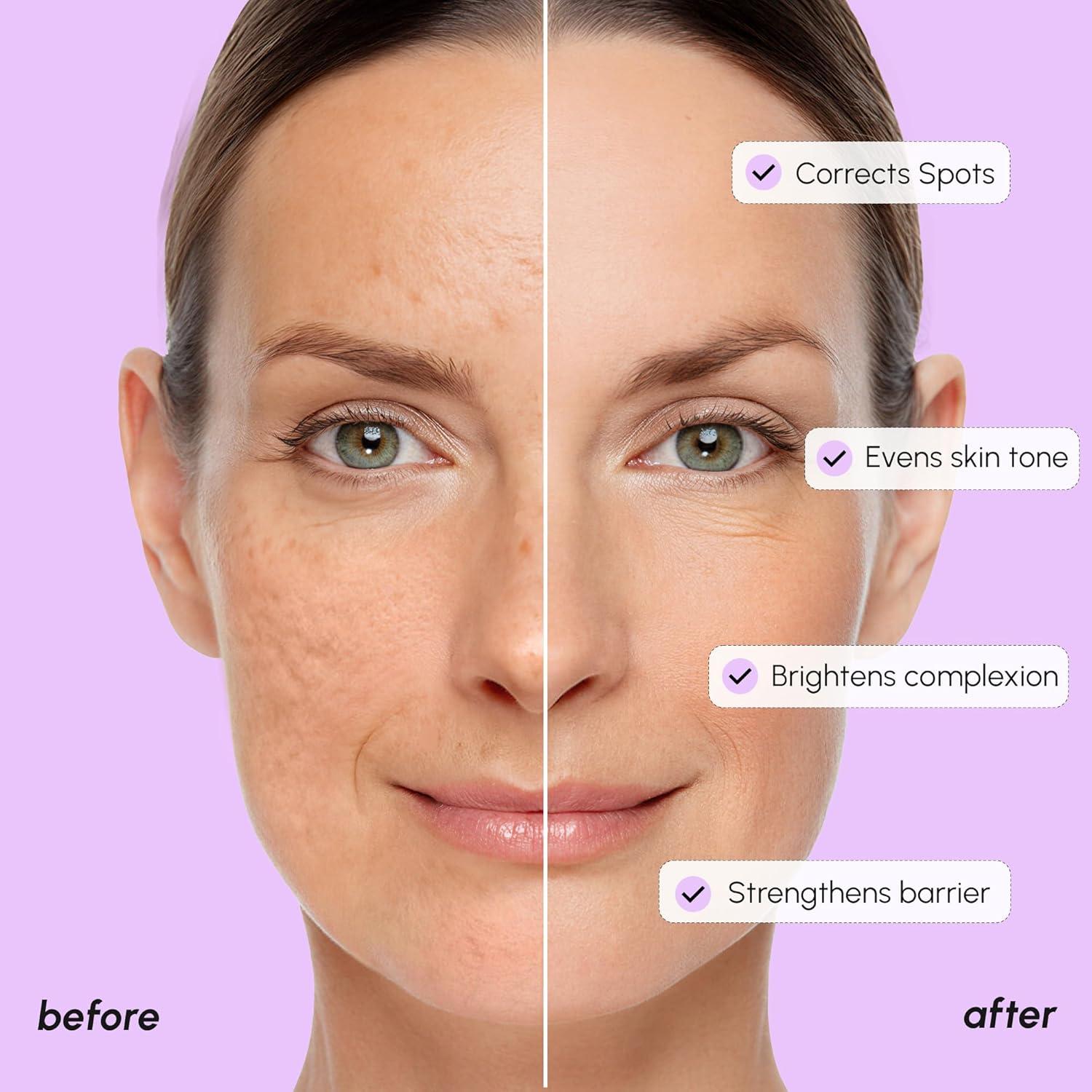 MAREE 20% Tranexamic Acid Serum Complex with Niacinamide & Vitamin C – Serum for Face & Body Dark Spot Corrector – Age Spots Hyperpigmentation Care Remover – Brightening Acido Tranexamico para Manchas(Tranexamic Acid Face Serum)