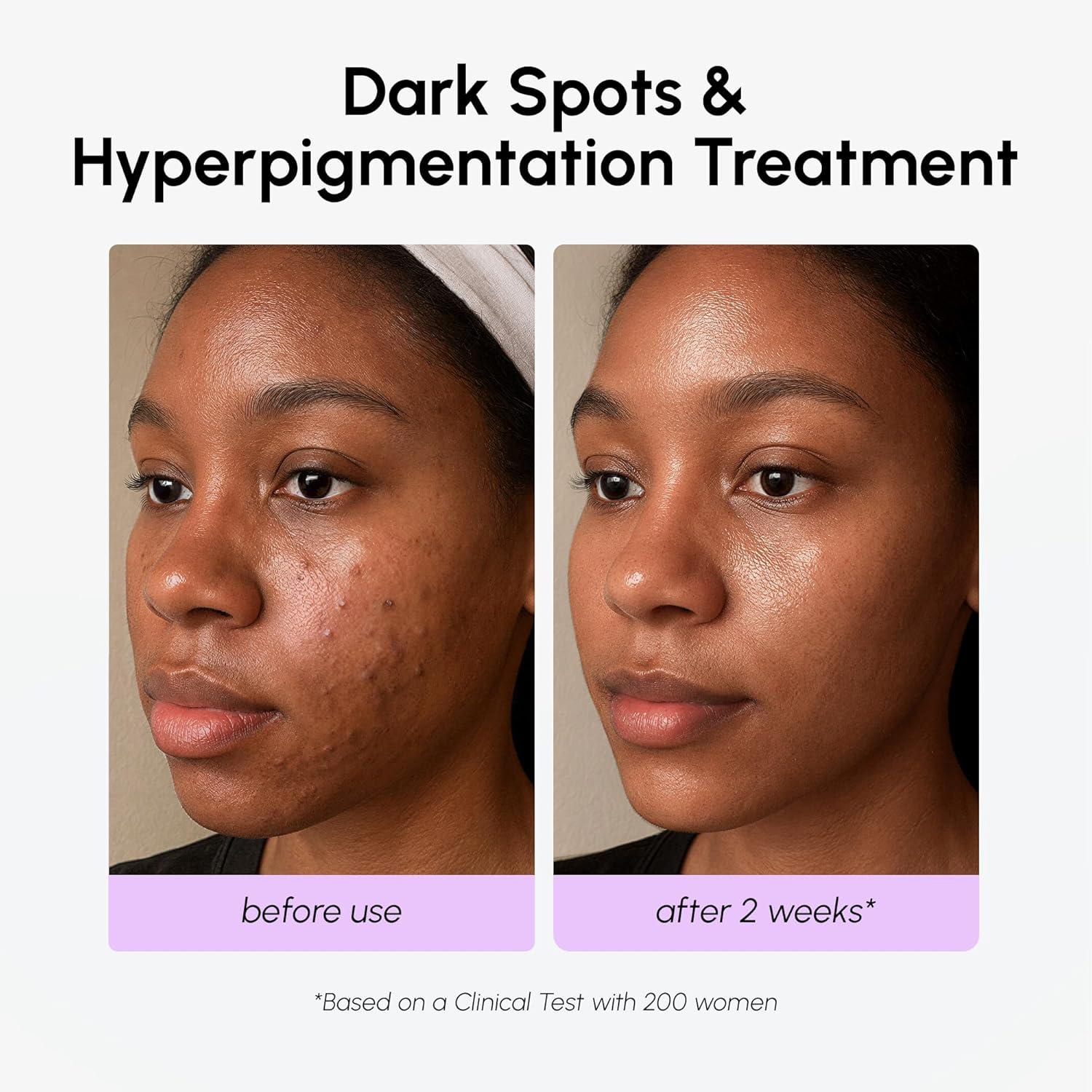 MAREE 20% Tranexamic Acid Serum Complex with Niacinamide & Vitamin C – Serum for Face & Body Dark Spot Corrector – Age Spots Hyperpigmentation Care Remover – Brightening Acido Tranexamico para Manchas(Tranexamic Acid Face Serum)