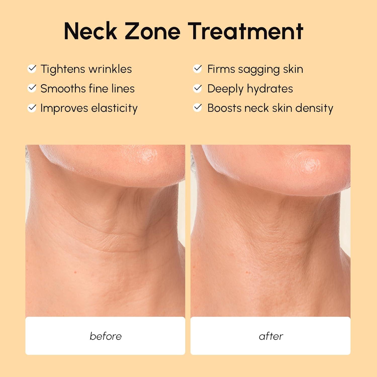 MAREE Neck Wrinkle Patches – Collagen Anti-Wrinkle Patches with Retinol & Hyaluronic Acid for Face Lift – Neck Mask for Tightening and Firming – Neck Lifting Mask & Face Tape for Neck Wrinkles – 5 Pcs