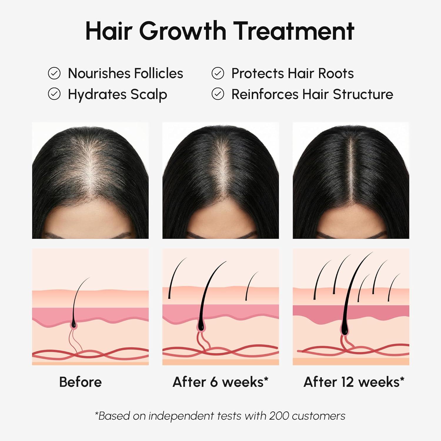 MAREE Batana Oil for Hair Growth – 100% Natural Botana Oils Hair Growth – Raw Batama Oil Paste from Honduras – Density, Thickness & Scalp Soothing for Women and Men – Aceite de Batana Para el Cabello(4.9 Ounce (Pack of 1))
