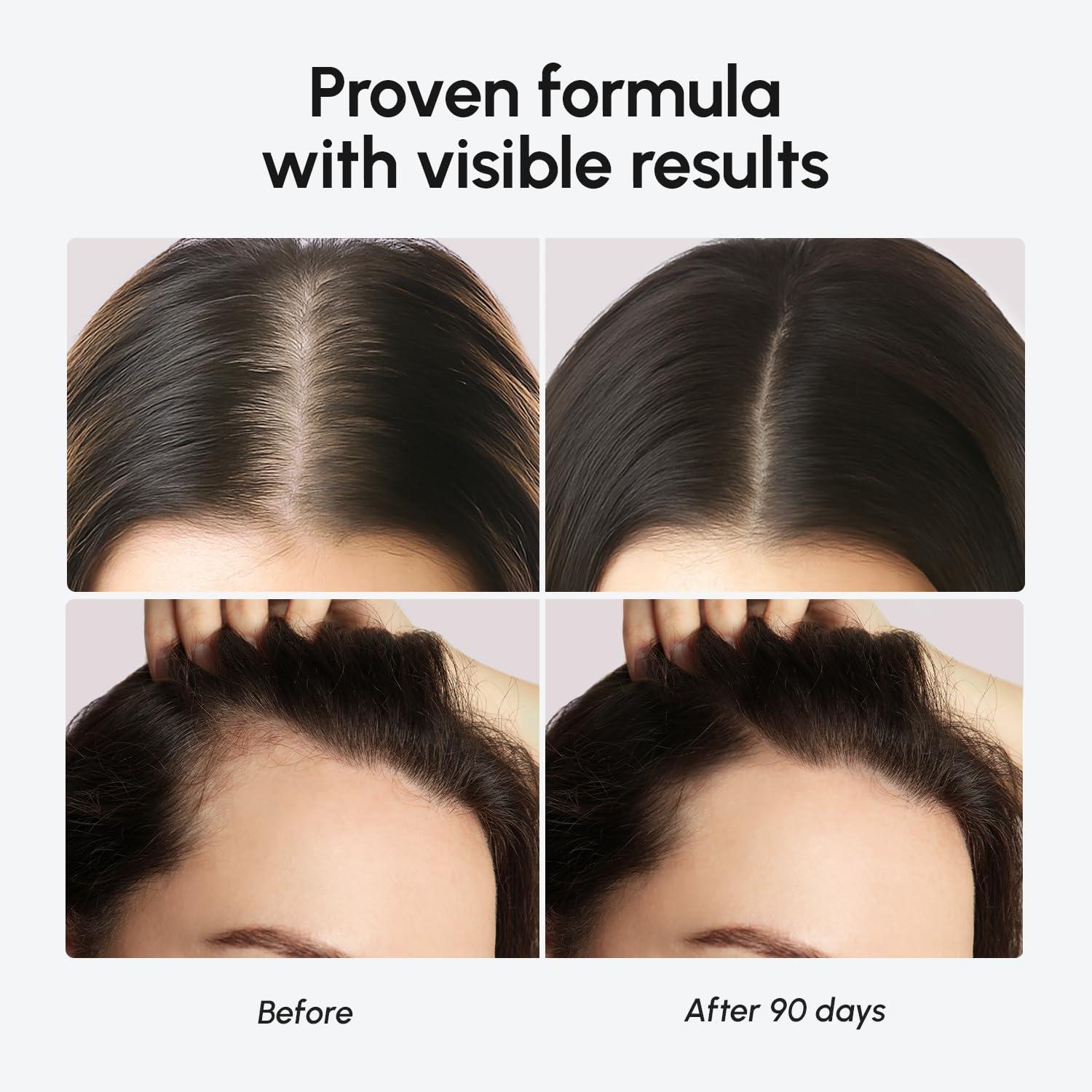 MAREE Hair Growth Spray – Caffeine, Batana, Castor & Rosemary Oil for Hair Growth – Products for Women & Men – Hair Oils for Hair Growth – Hair Thickening Spray for Roots – Hair Regrowth & Scalp Care(Hair Growth Serum)