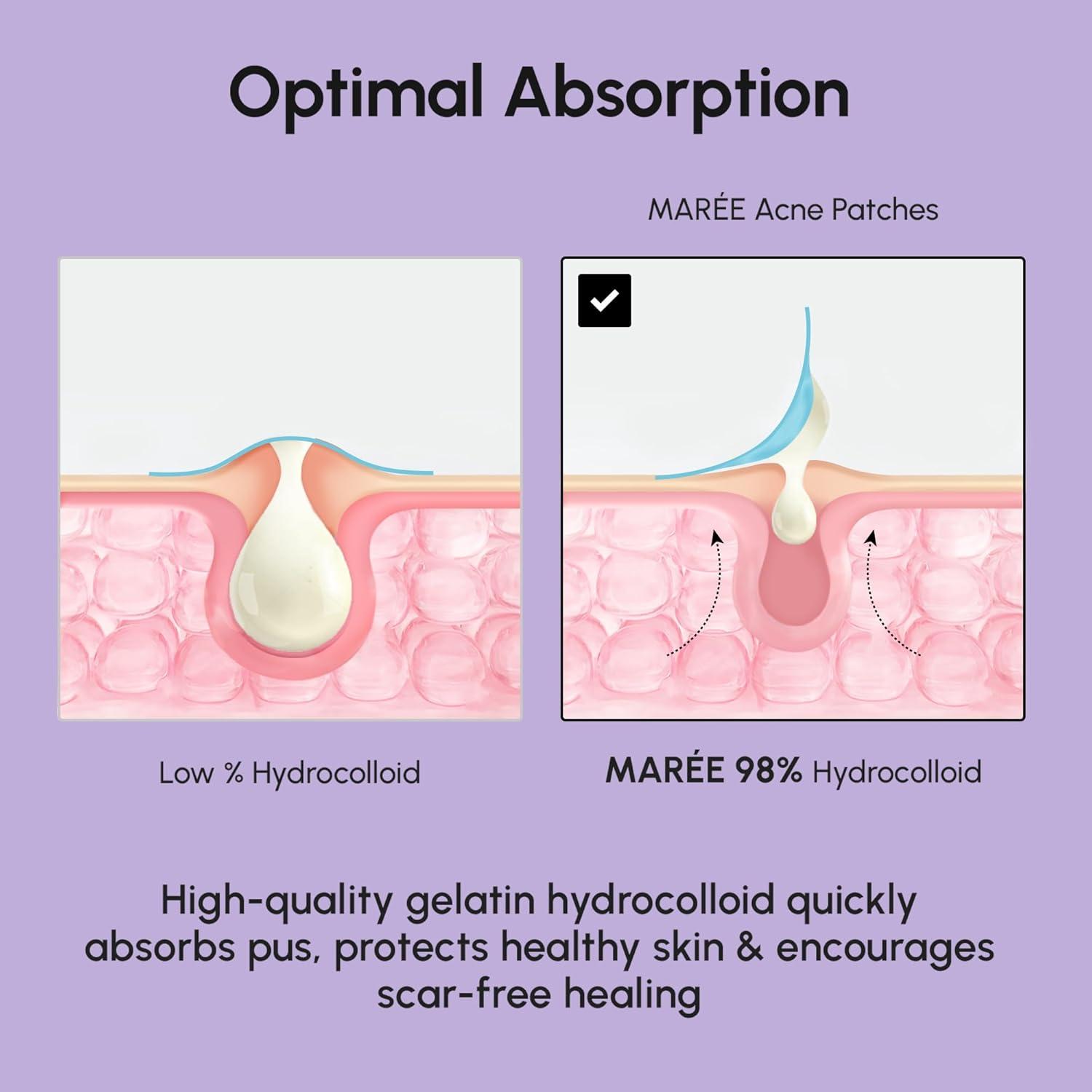 MAREE Invisible Pimple Patches – Clear Pimple Patches for Face – Hydrocolloid Acne Patches Anti Blemish – Zit Stickers for Face – Parches Para Acne – Pinple Zit Patches Pimple Stickers – 72 Dots(Holographic)