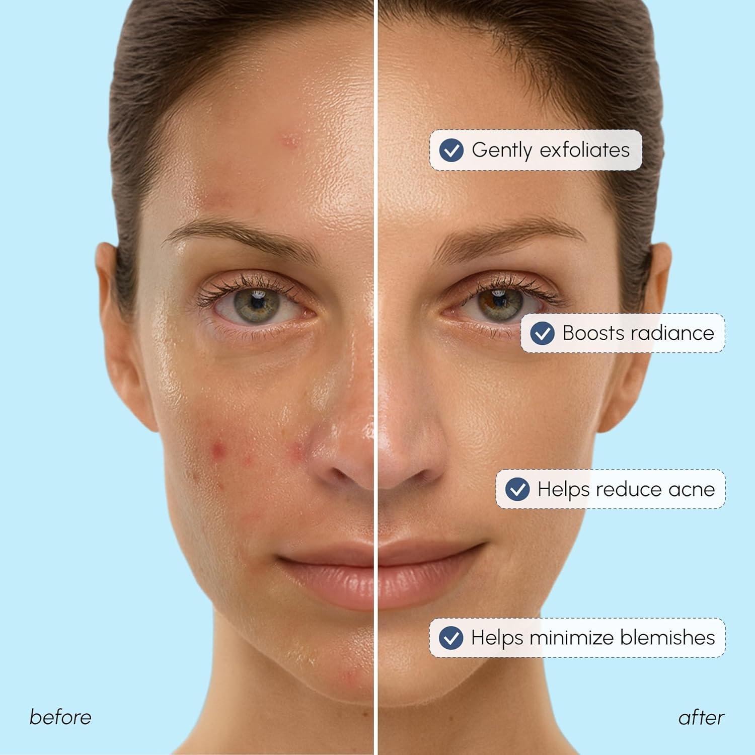 MAREE Exfoliating Toner with Salicylic Acid – AHA BHA Face Exfoliant & Pore Cleaner – BHA Liquid Exfoliant for Sebum & Dead Skin Care Remover – Face Exfoliator – Acido Salicilico Exfoliante Facial(Glycolic Acid)