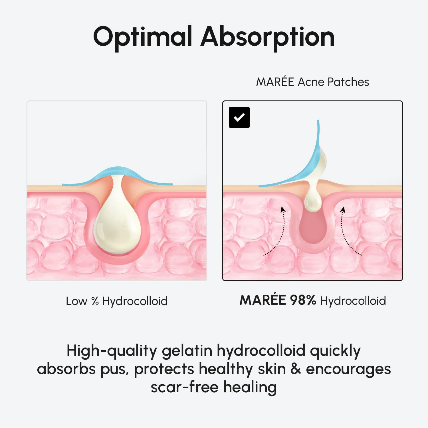 MAREE Invisible Pimple Patches – Clear Pimple Patches for Face – Hydrocolloid Acne Patches Anti Blemish – Zit Stickers for Face – Parches Para Acne – Pinple Zit Patches Pimple Stickers – 72 Dots(Clear)
