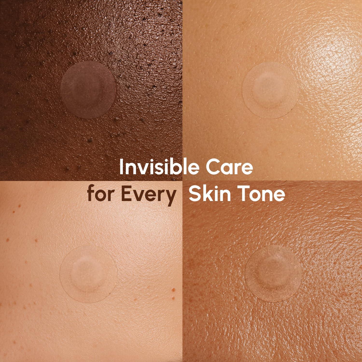 MAREE Invisible Pimple Patches – Clear Pimple Patches for Face – Hydrocolloid Acne Patches Anti Blemish – Zit Stickers for Face – Parches Para Acne – Pinple Zit Patches Pimple Stickers – 72 Dots(Clear)