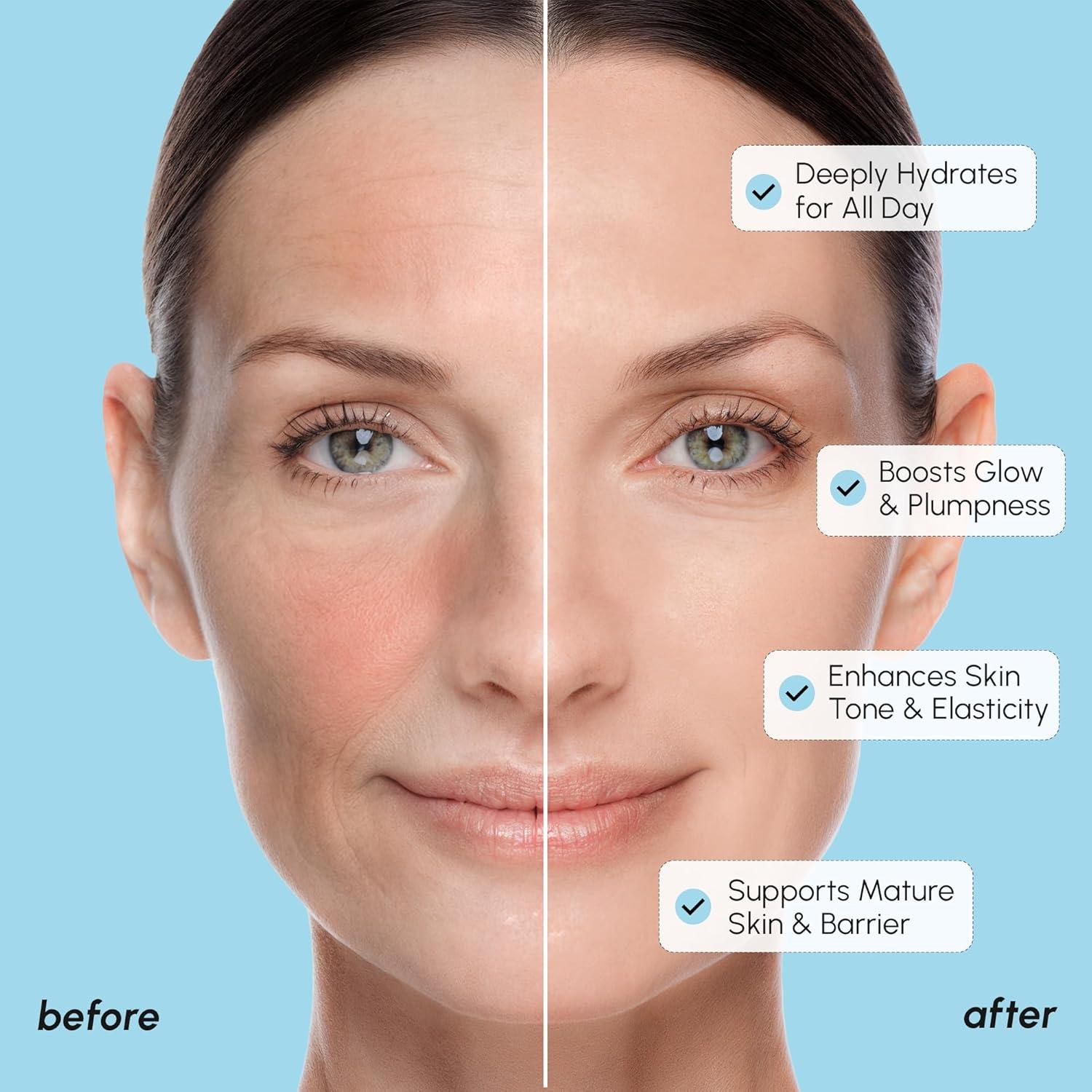 MAREE Exfoliating Toner with Salicylic Acid – AHA BHA Face Exfoliant & Pore Cleaner – BHA Liquid Exfoliant for Sebum & Dead Skin Care Remover – Face Exfoliator – Acido Salicilico Exfoliante Facial(Milky)