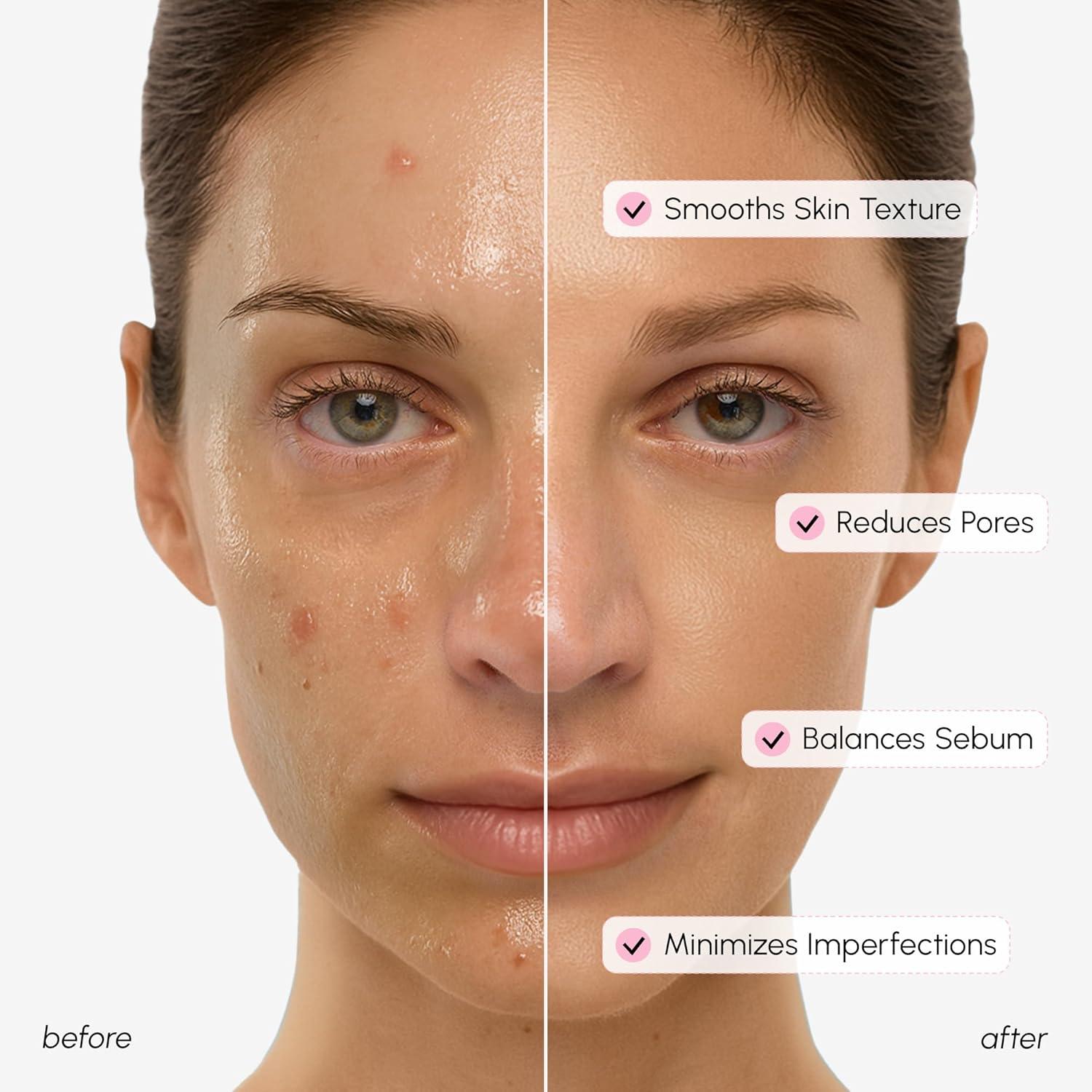 MAREE Exfoliating Toner with Salicylic Acid – AHA BHA Face Exfoliant & Pore Cleaner – BHA Liquid Exfoliant for Sebum & Dead Skin Care Remover – Face Exfoliator – Acido Salicilico Exfoliante Facial(Pore Minimizing)