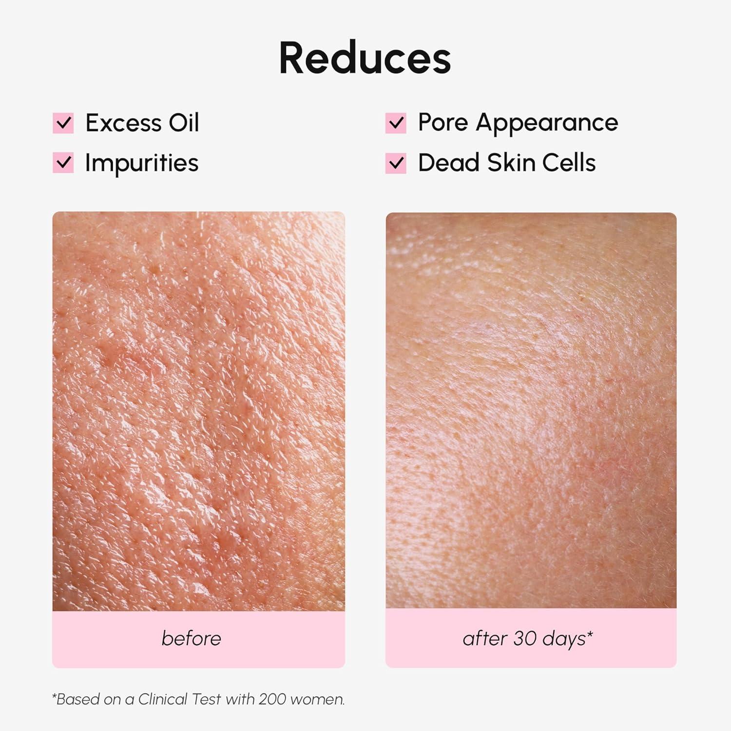 MAREE Exfoliating Toner with Salicylic Acid – AHA BHA Face Exfoliant & Pore Cleaner – BHA Liquid Exfoliant for Sebum & Dead Skin Care Remover – Face Exfoliator – Acido Salicilico Exfoliante Facial(Pore Minimizing)