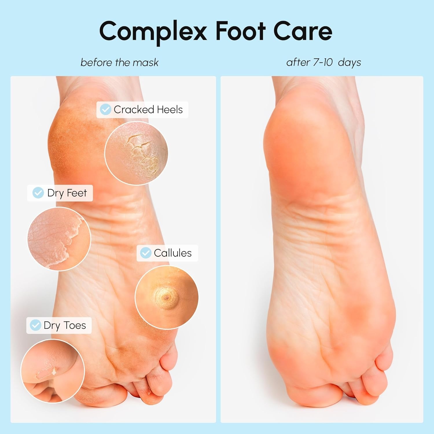 MAREE Foot Peeling Mask – 3-in-1 Foot Mask for Dry Cracked Feet, Callus Remover – Dead Skin Exfoliating Foot Peel Mask with Glycolic Acid – Moisturizing Socks for Men – Spa Self Care Gifts for Women(Coconut)