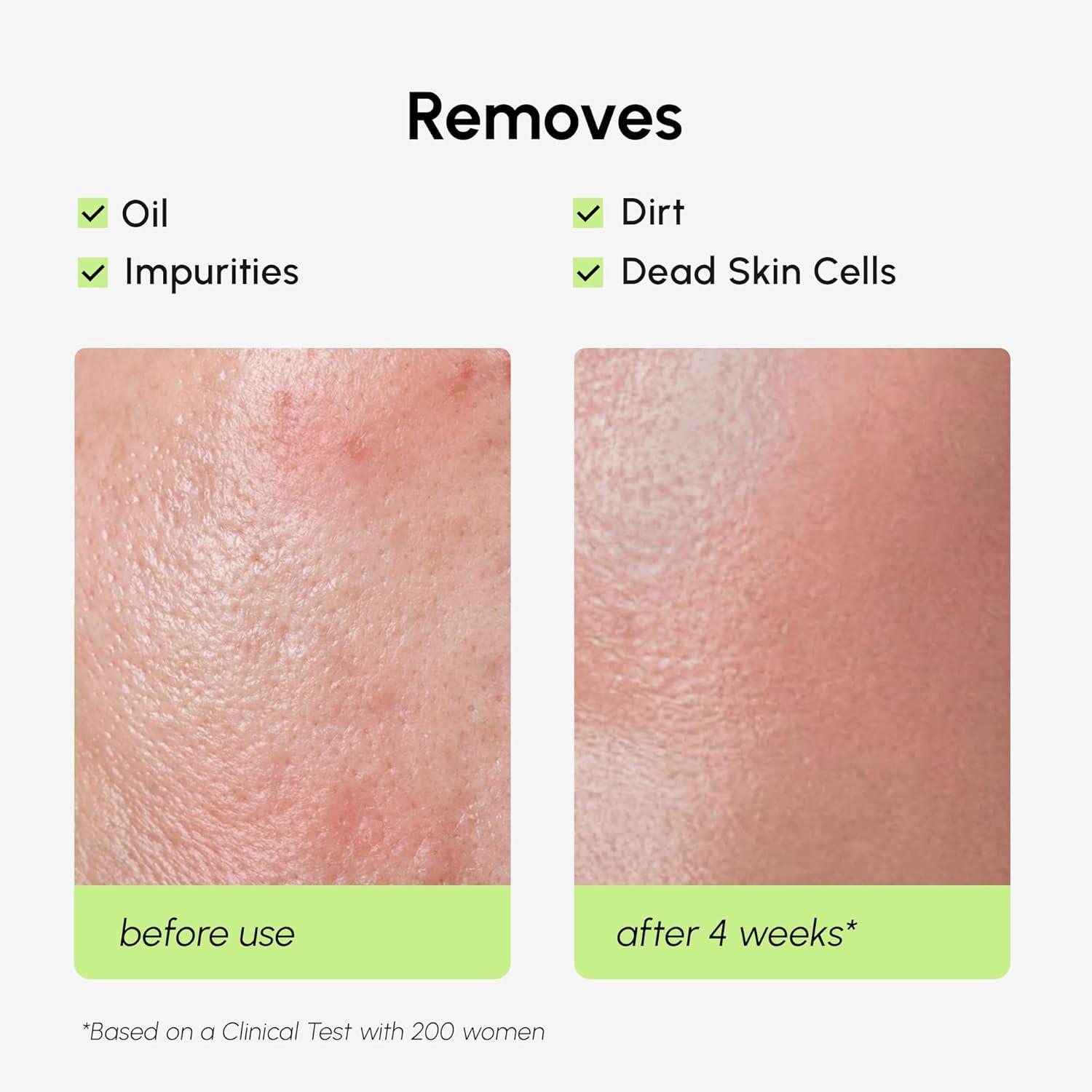 MAREE Exfoliating Toner with Salicylic Acid – AHA BHA Face Exfoliant & Pore Cleaner – BHA Liquid Exfoliant for Sebum & Dead Skin Care Remover – Face Exfoliator – Acido Salicilico Exfoliante Facial(Exfoliating)