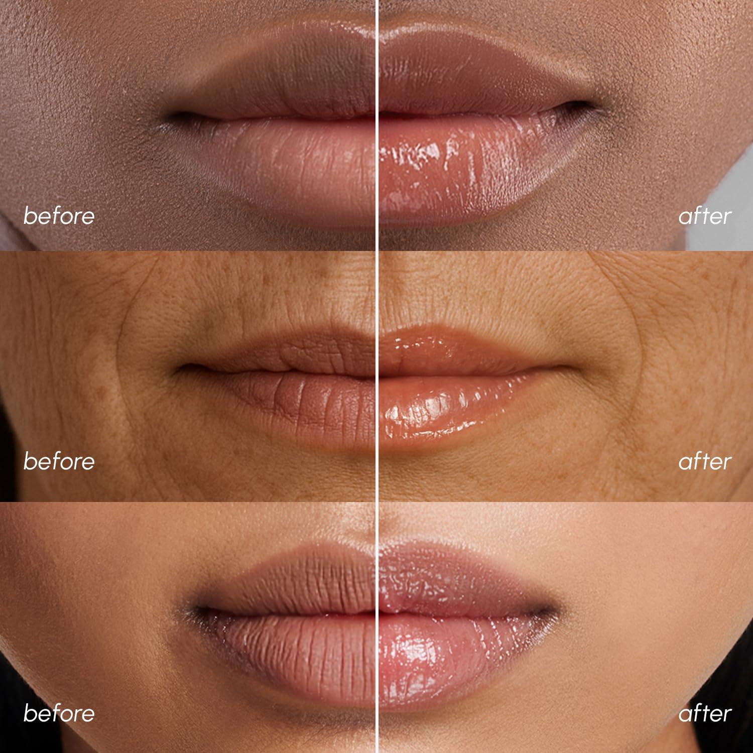 MAREE Lip Mask Overnight – Lip Moisturizer For Very Dry Lips – Hydrating Lip Butter Balm with Hyaluronic Acid & Collagen – Overnight Lip Treatment – Lip Sleeping Mask Repair – Hidratante de Labios(Lip Mask 2 Pack)